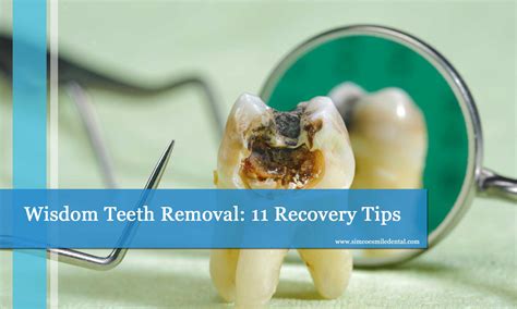 can i shower after wisdom teeth removal|Showering After Wisdom Tooth Removal: What You Need To Know